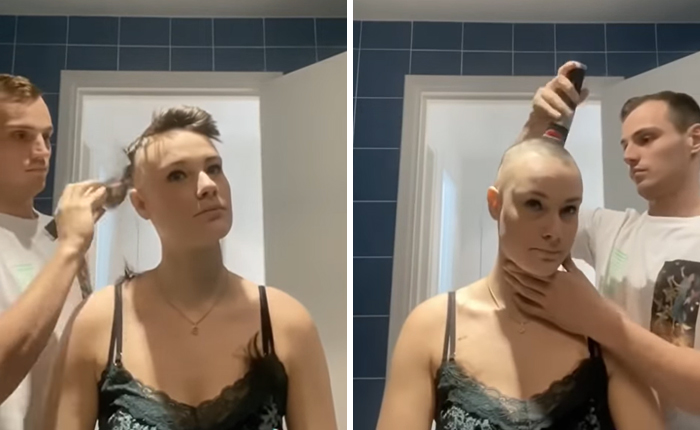 due to alopecia boyfriend shaves girlfriend's head only to shave his own immediately after