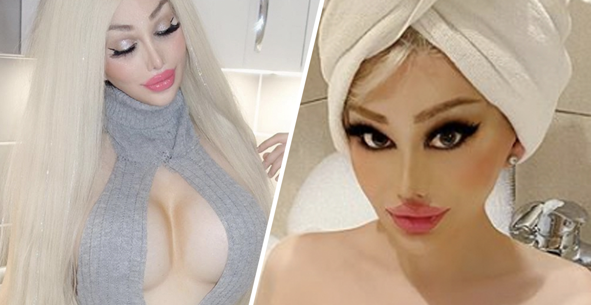 woman, 22, who spent £75k on plastic surgery says she's 'too hot to work'