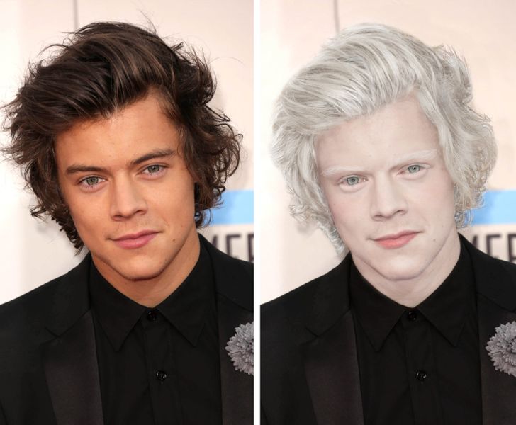 what 15 celebs would look like if they were albinos