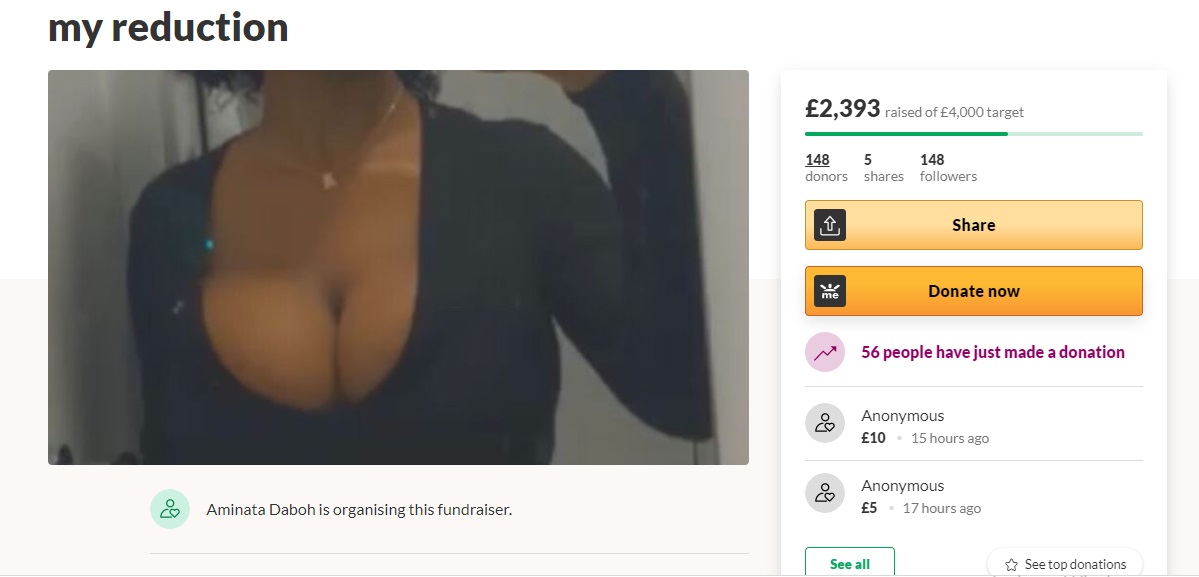 student with 32hh breasts crowdfunds to raise money for breast reduction