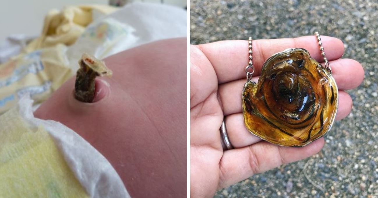 Moms Are Now Turning Their Babies' Umbilical Cords Into Jewelry