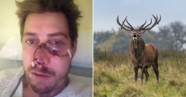 Deer Rips Off Hunter's Face As He Tries To Shoot It