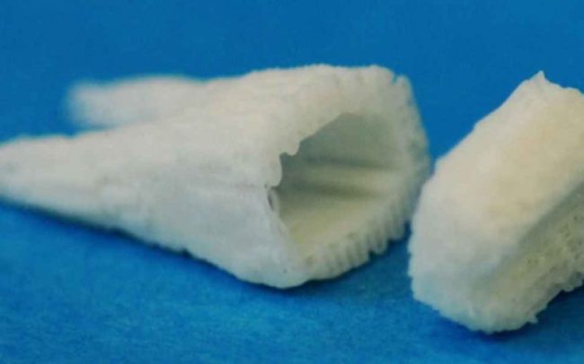 No More Fake Teeth: Stem Cell Dental Implants Grow New Teeth In 2 Months