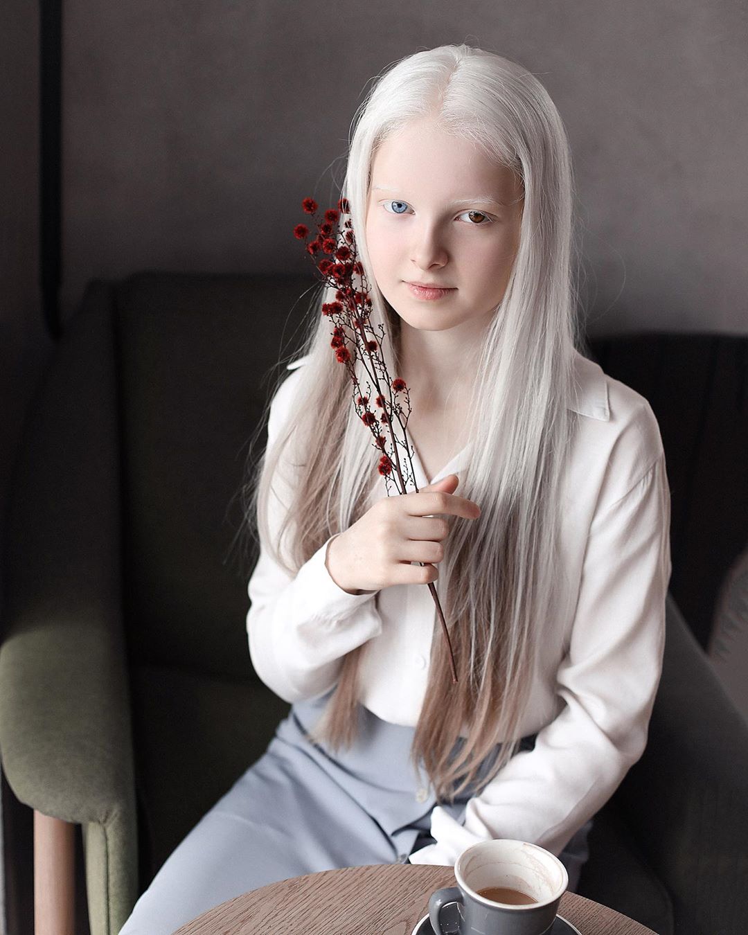 amina ependieva – a girl who inherited two genetic mutations and exceptional beauty