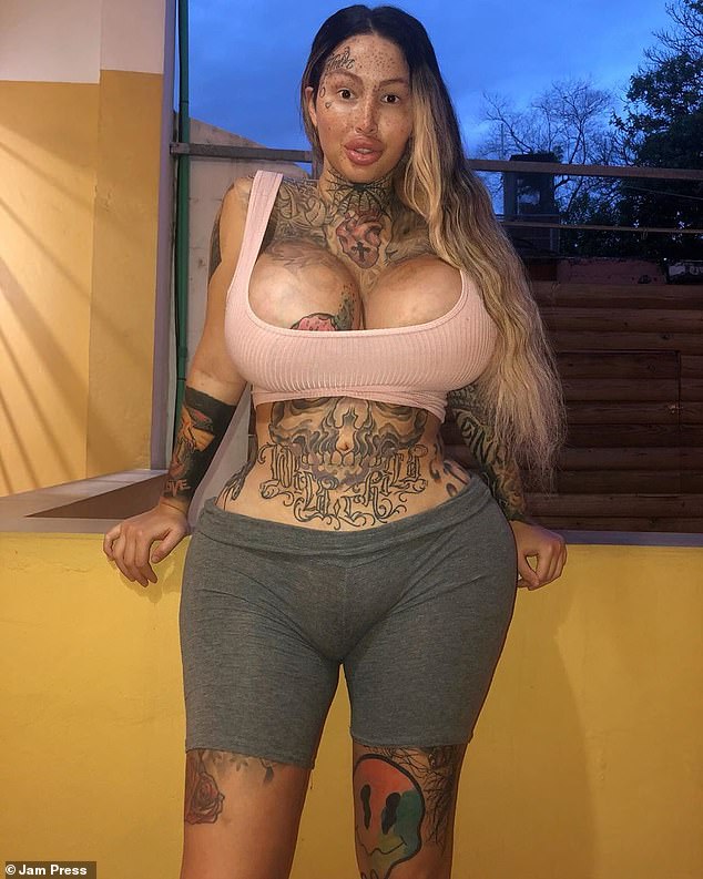 model who had vaginal surgery to make it fattest in world suffers complications