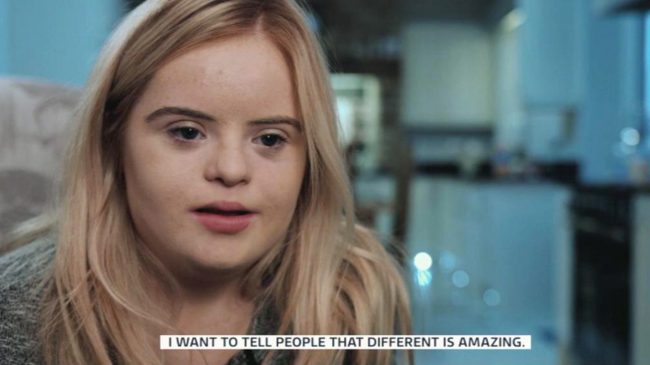 popular cosmetic brand chooses model with down syndrome as ambassador