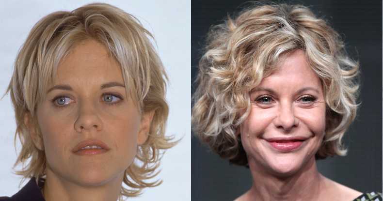 meg ryan plastic surgery: the disaster that left her looking like a 