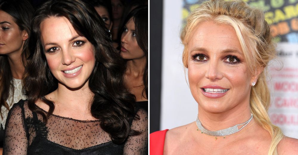 10+ Pics Of Celebs Before And After They Had Plastic Surgery
