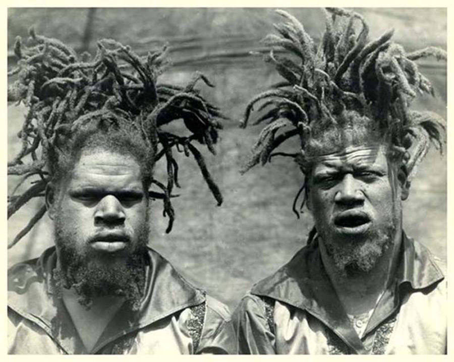 George And Willie Muse: Black Albino Brothers Who Were Kidnapped By The Circus And Displayed As Freaks