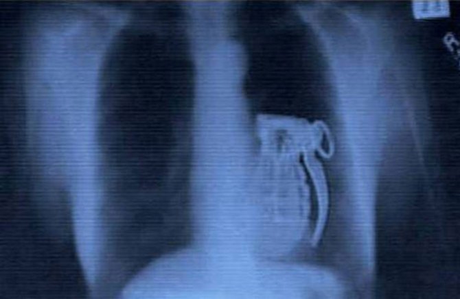 15 Strange And Funny X-Ray Images That Will Make You Squirm