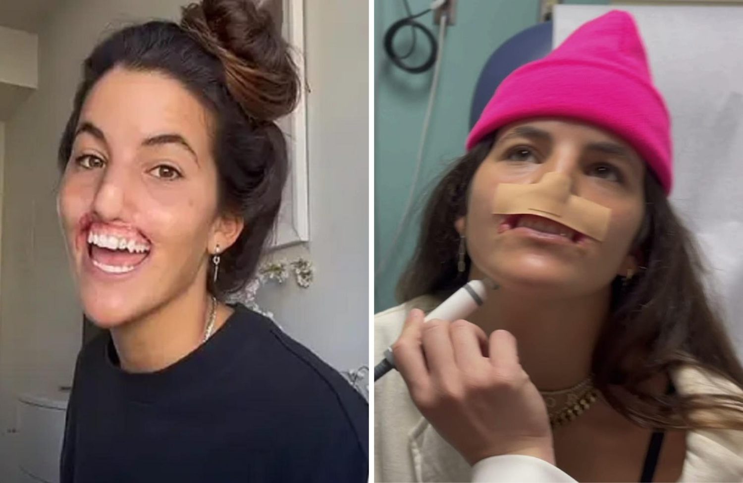 Model Undergoes $400k Surgery To Restore Smile Ripped Off By Pit Bull