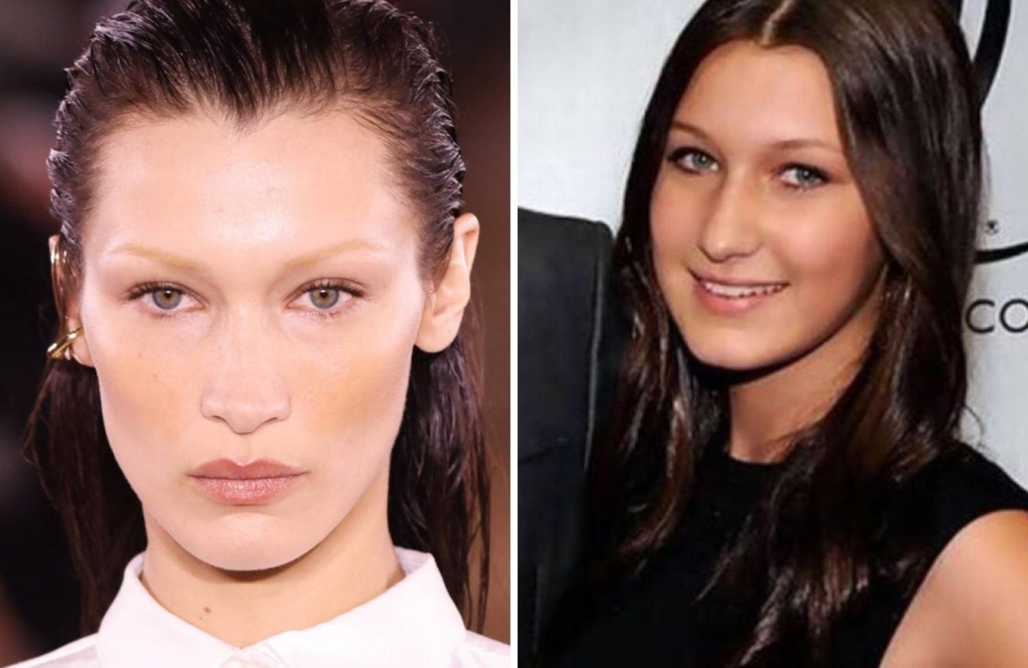 Bella Hadid Admits To Having Plastic Surgery Aged 14 After Feeling Like Gigi Hadid's 'ugly Sister'
