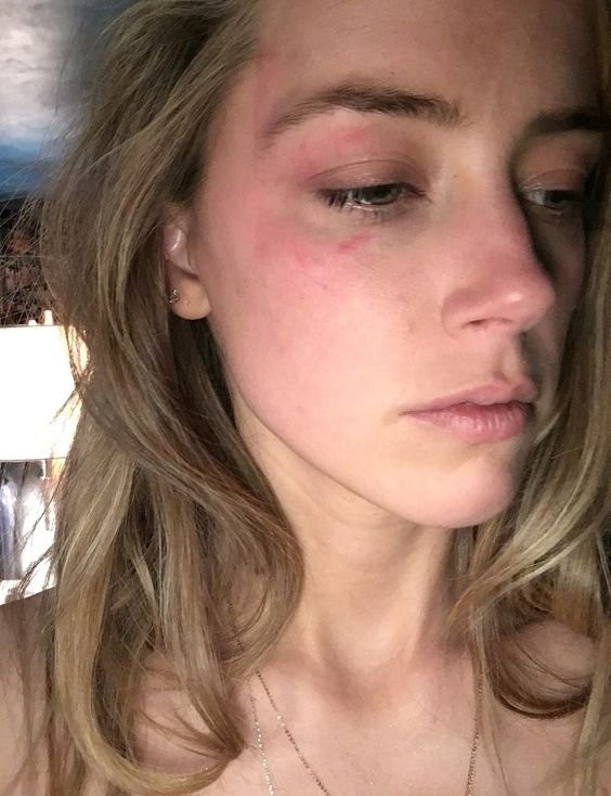 Amber Heard Could Face Jail Over Claims She "edited Injury Photos"