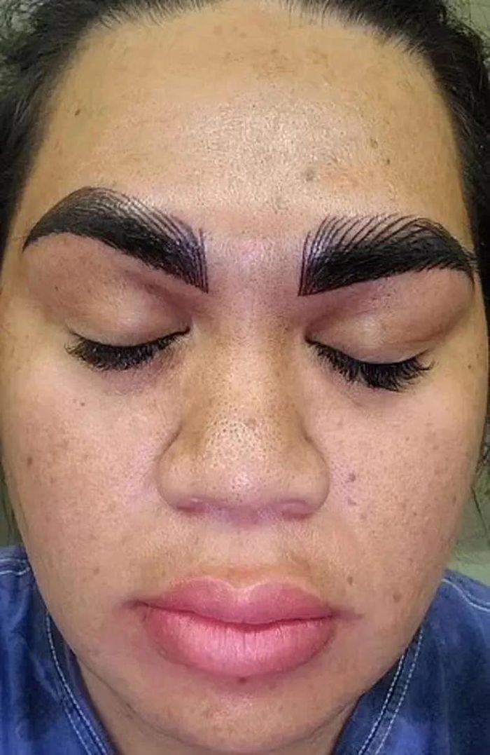 Horrified Mother Is Left With Huge And Thick Eyebrows After Microblading Treatment Went Wrong