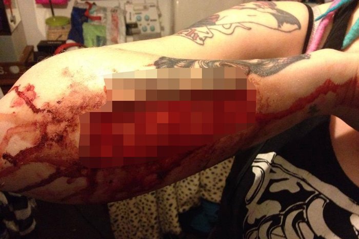 Woman Cuts Off Her Arm Tattoo Having Her Cheating Boyfriend's Name And Mails Him The Skin