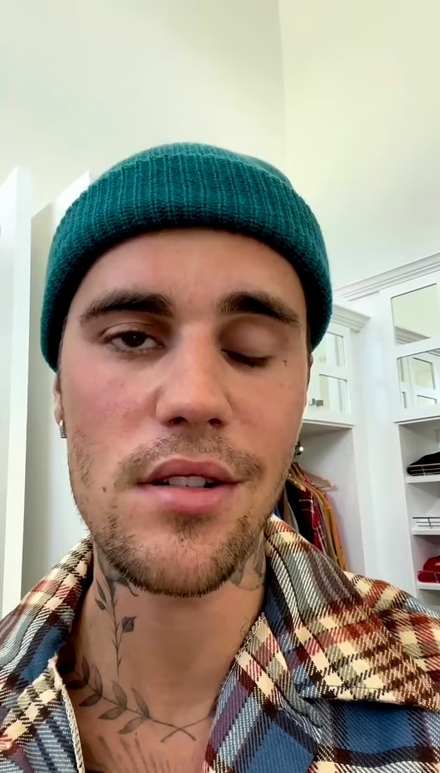 Justin Bieber Reveals He Has Facial Paralysis From Ramsayhunt Syndrome
