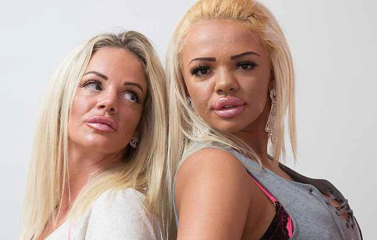 Mother And Daughter Spend $86k On Plastic Surgery To Look Like Celeb Idol