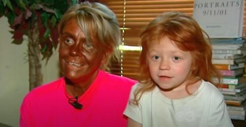 The Transformation Of 'Tan Mom': Patricia Krentcil's New Look And Life After Excessive Tanning