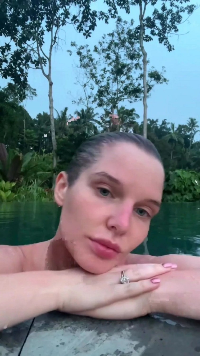 Helen Flanagan Goes For A Bold Skinny Dip In Pool After Revealing 'Burnt Boobs'