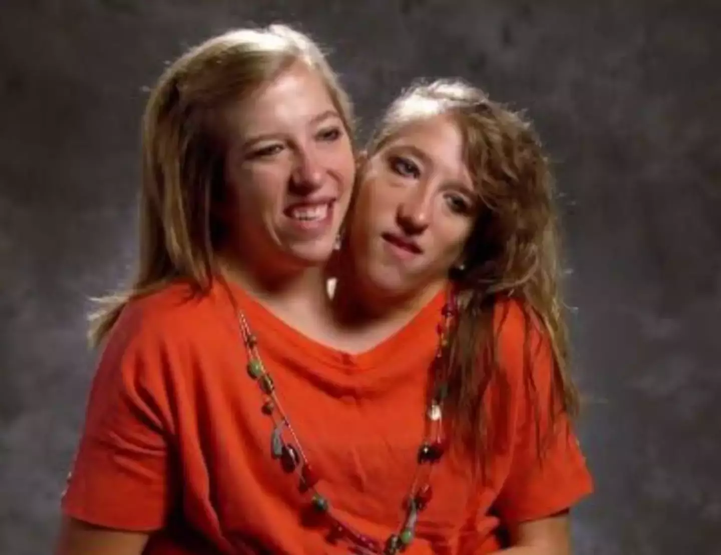 After Conjoined Twin Abby Hensel's Marriage, Everyone Wonders The Same Thing