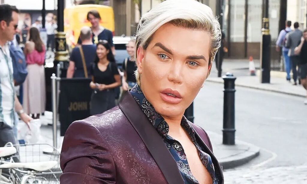Trans Woman Invests Million In Transformation From Human Ken Doll To Barbie