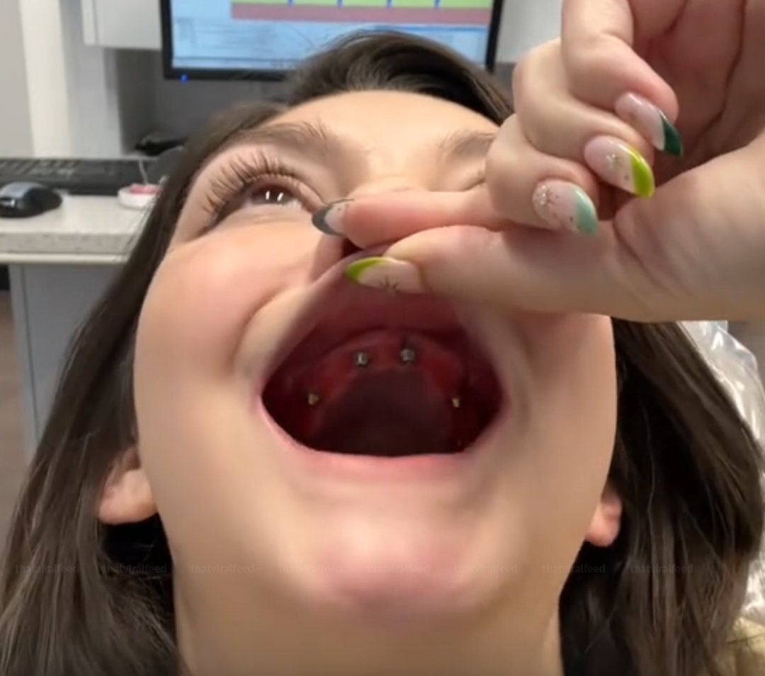 Woman's Inspiring Journey Of Receiving 'New Teeth' Moves Many To Tears