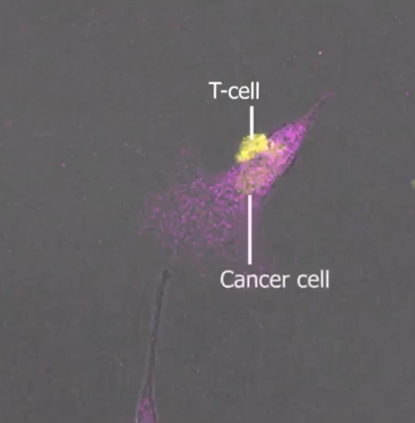Stunning Video Shows Immune Cell Defeating Aggressive Cancer Cell